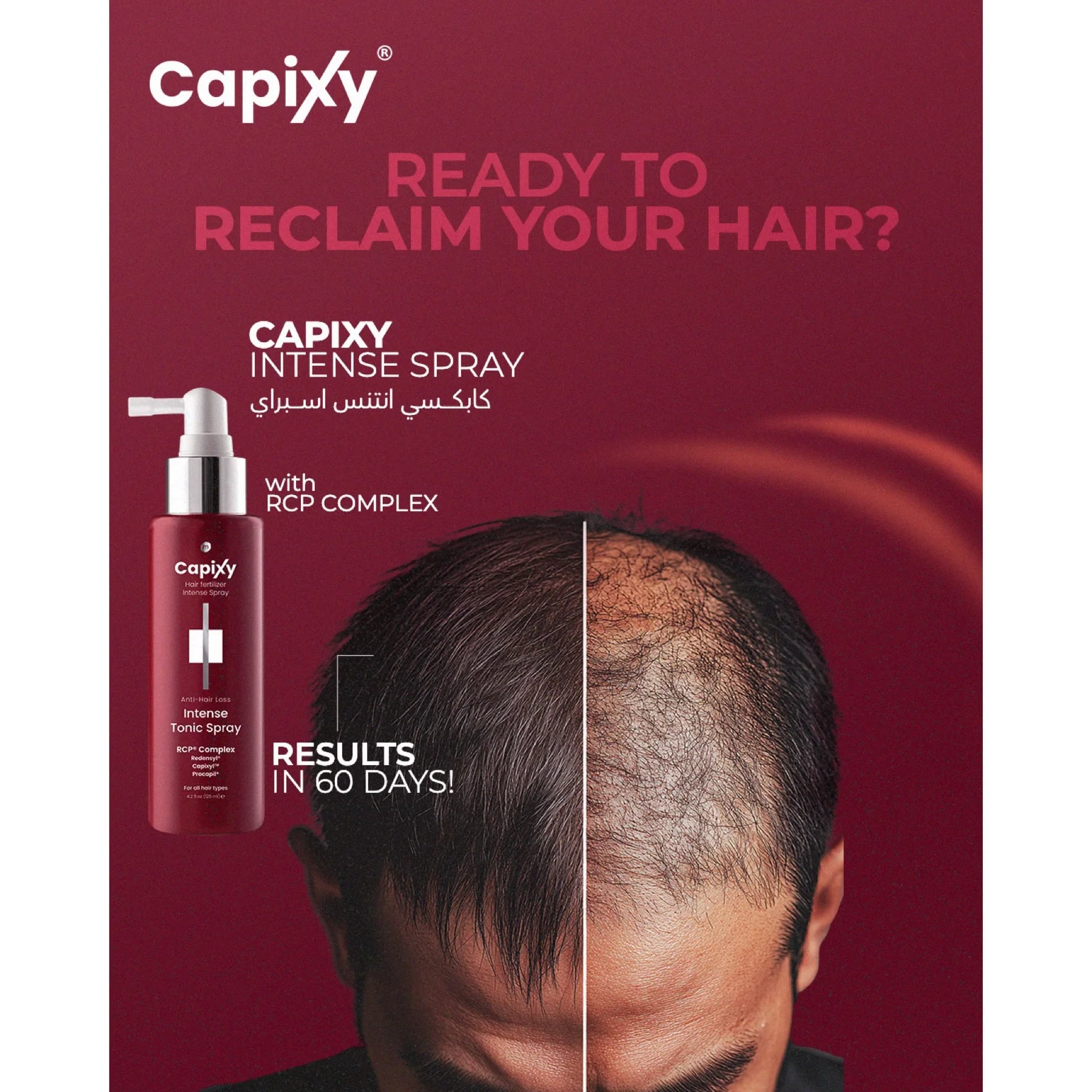 Capixy Intense Tonic Spray - Image 2