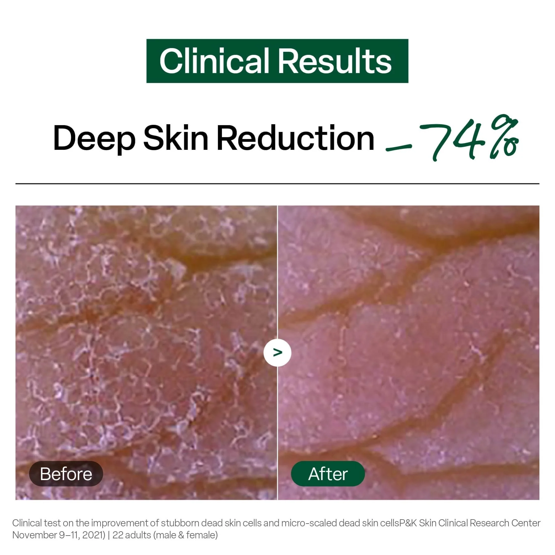 Dr.G Brightening Peeling Gel 120g - Image 4