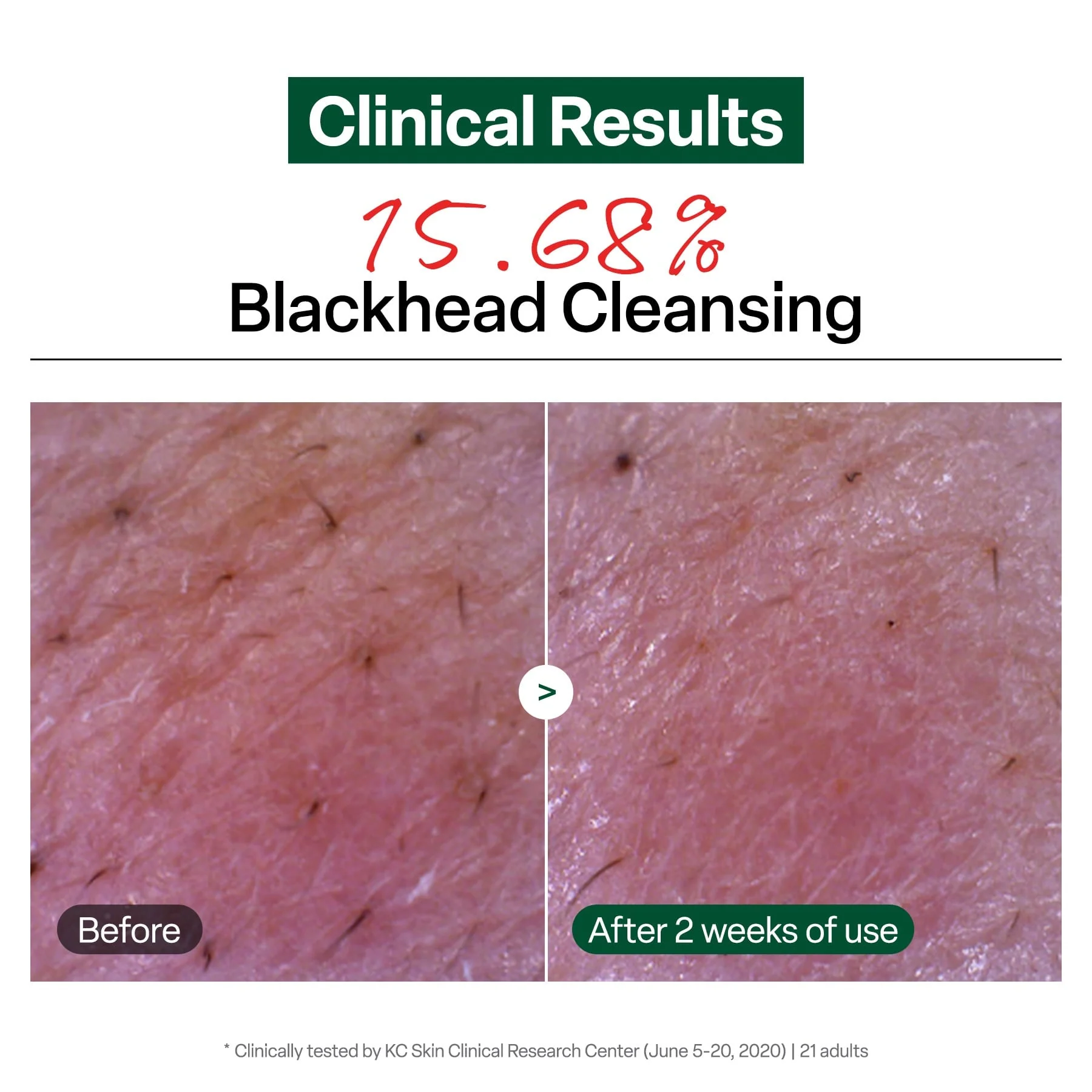Dr.G Green Deep Cleansing Oil 310ml - Image 4