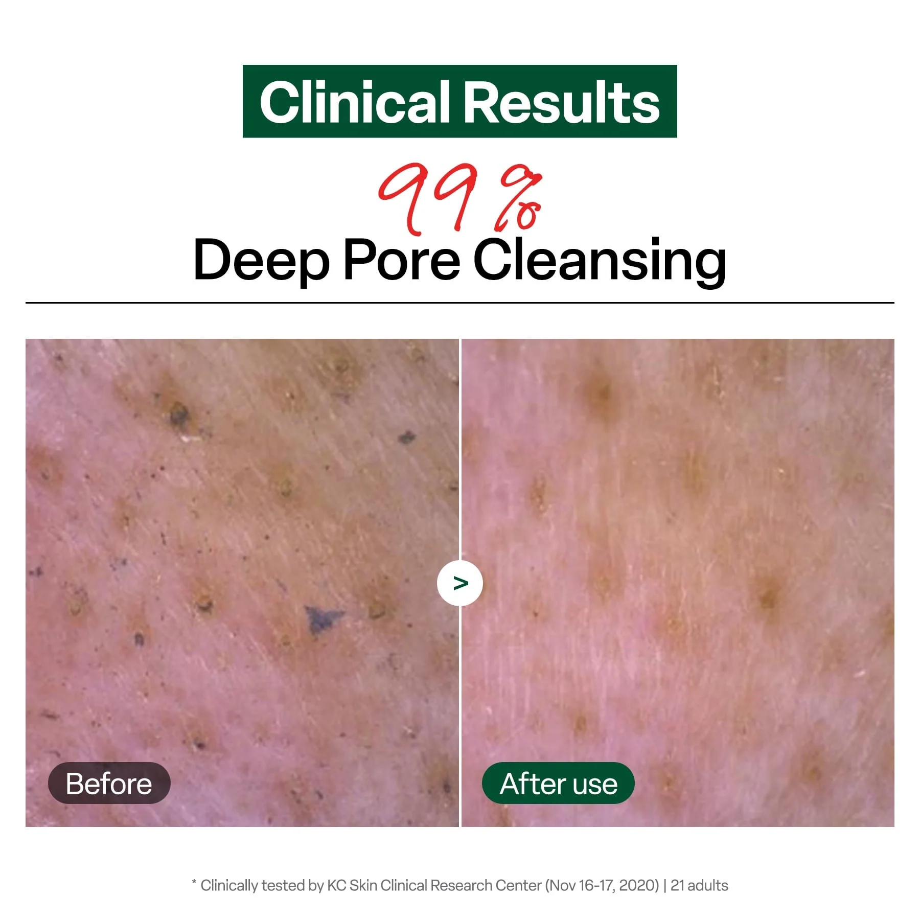 Dr.G Ph Cleansing Gel Foam 200ml - Image 4
