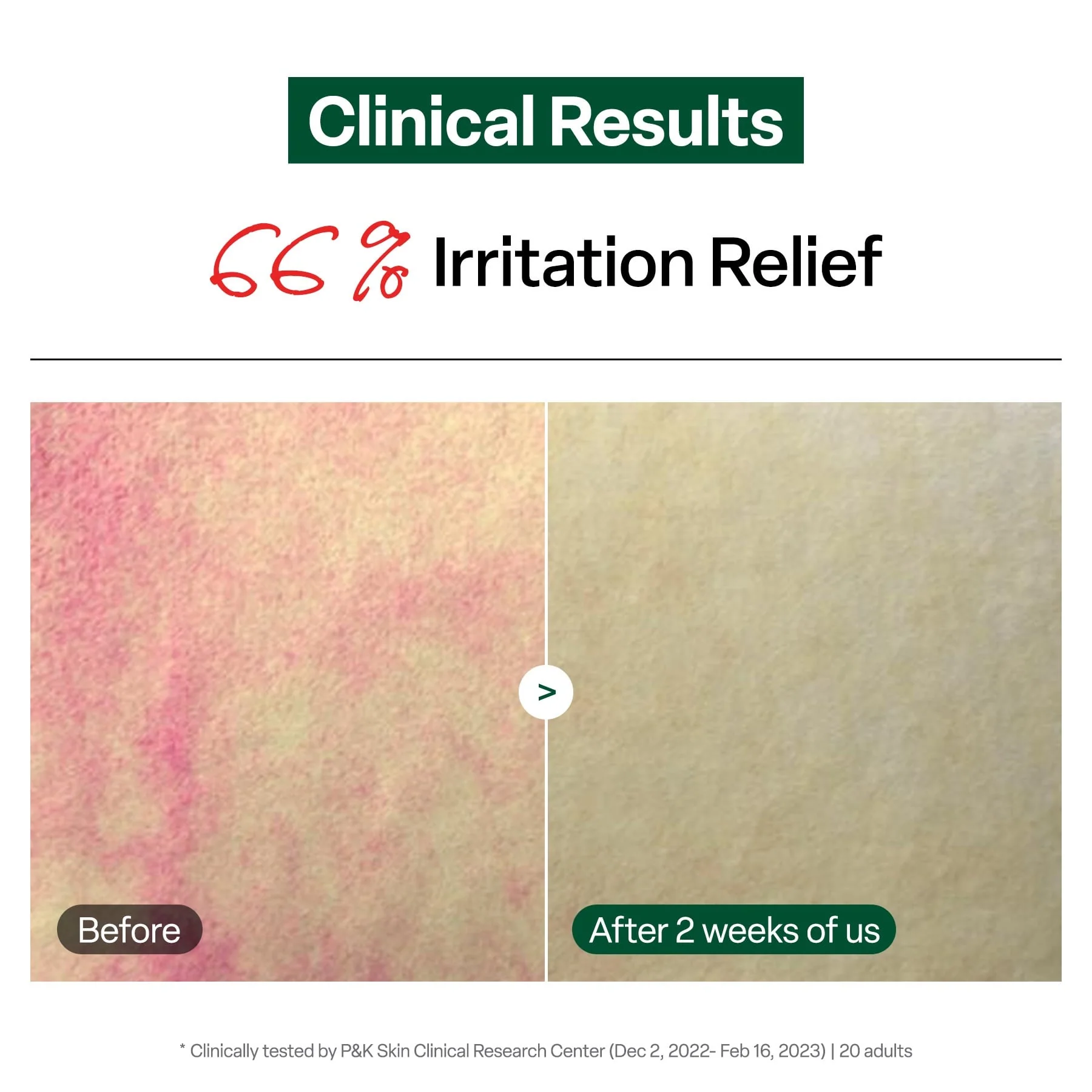 Dr.G Red Clear Sooth Toner 300ml - Image 4