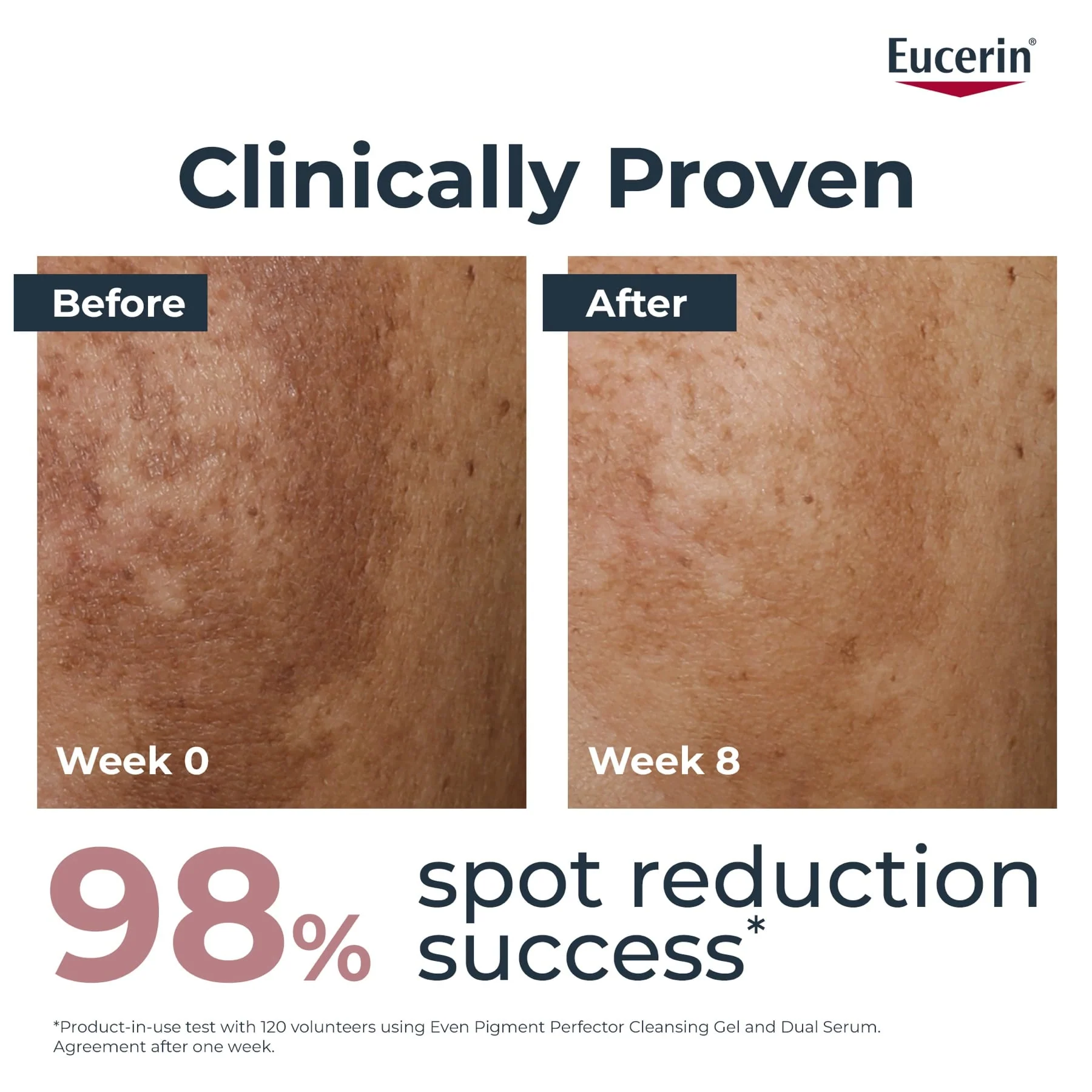 Eucerin Even Pigment Perfector Dual Face Serum 2X15ml - Image 3