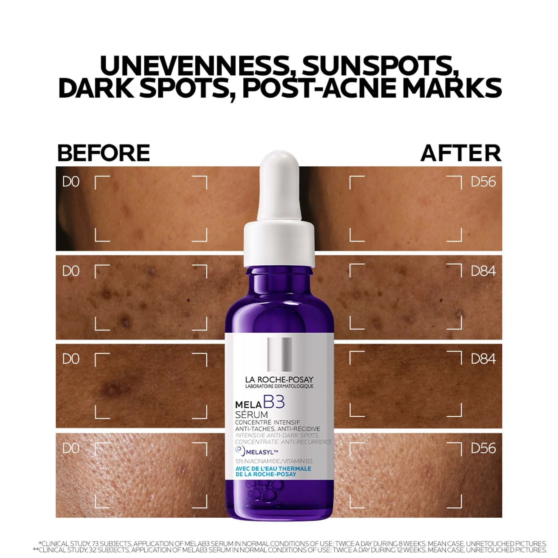 La Roche Posay Mela B3 Dark Spot Serum With Melasyl™ + Niacinamide - Image 4