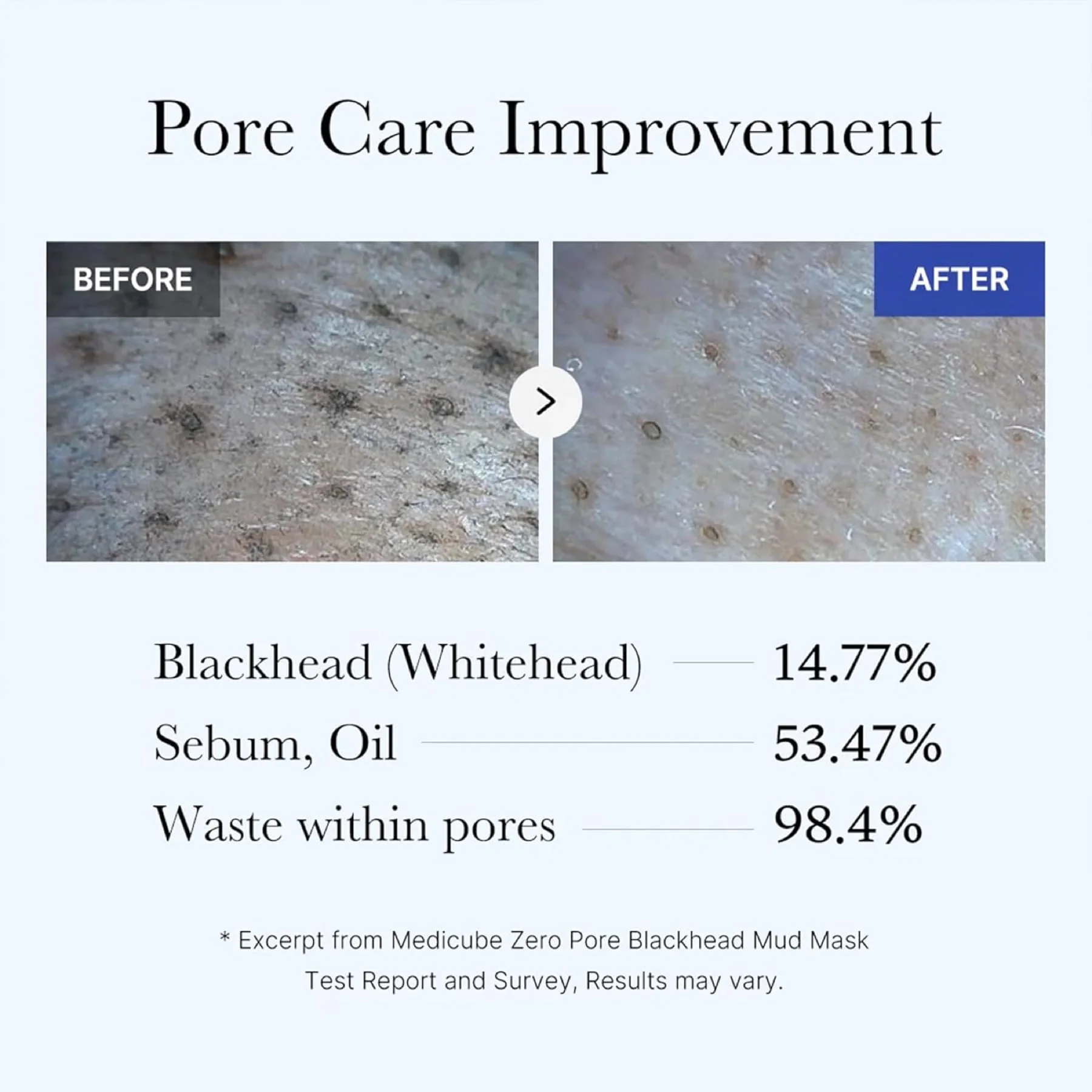 Medicube Zero Pore Blackhead Mud Facial Mask - Image 4
