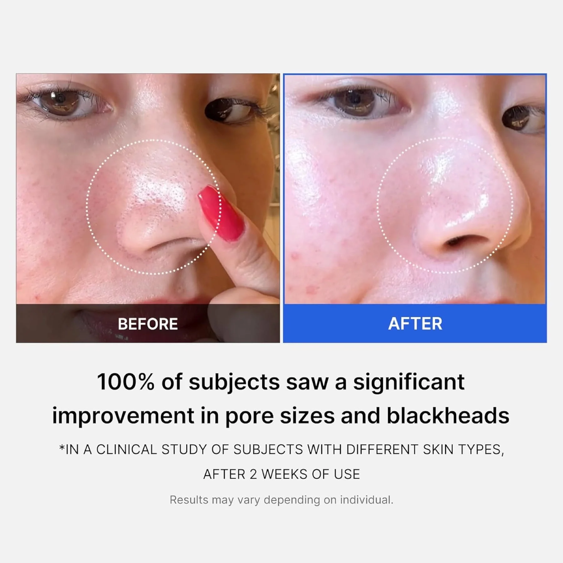 Medicube Zero Pore Pads 2.0 (70 Pads) - Image 4