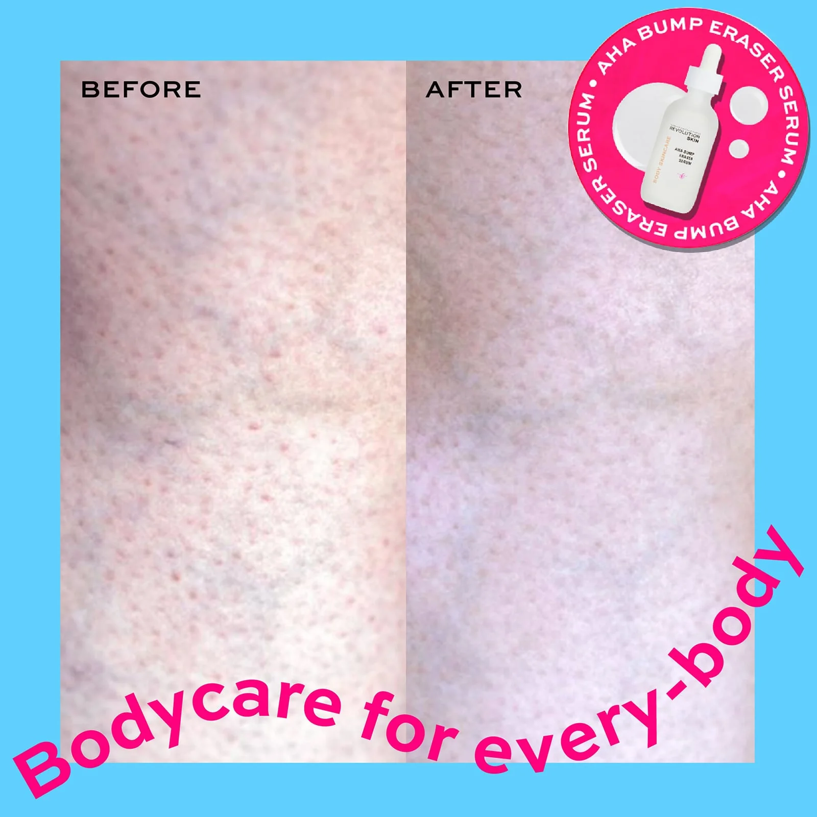 Revolution Skincare AHA Bump Eraser Serum 60ml - Image 3