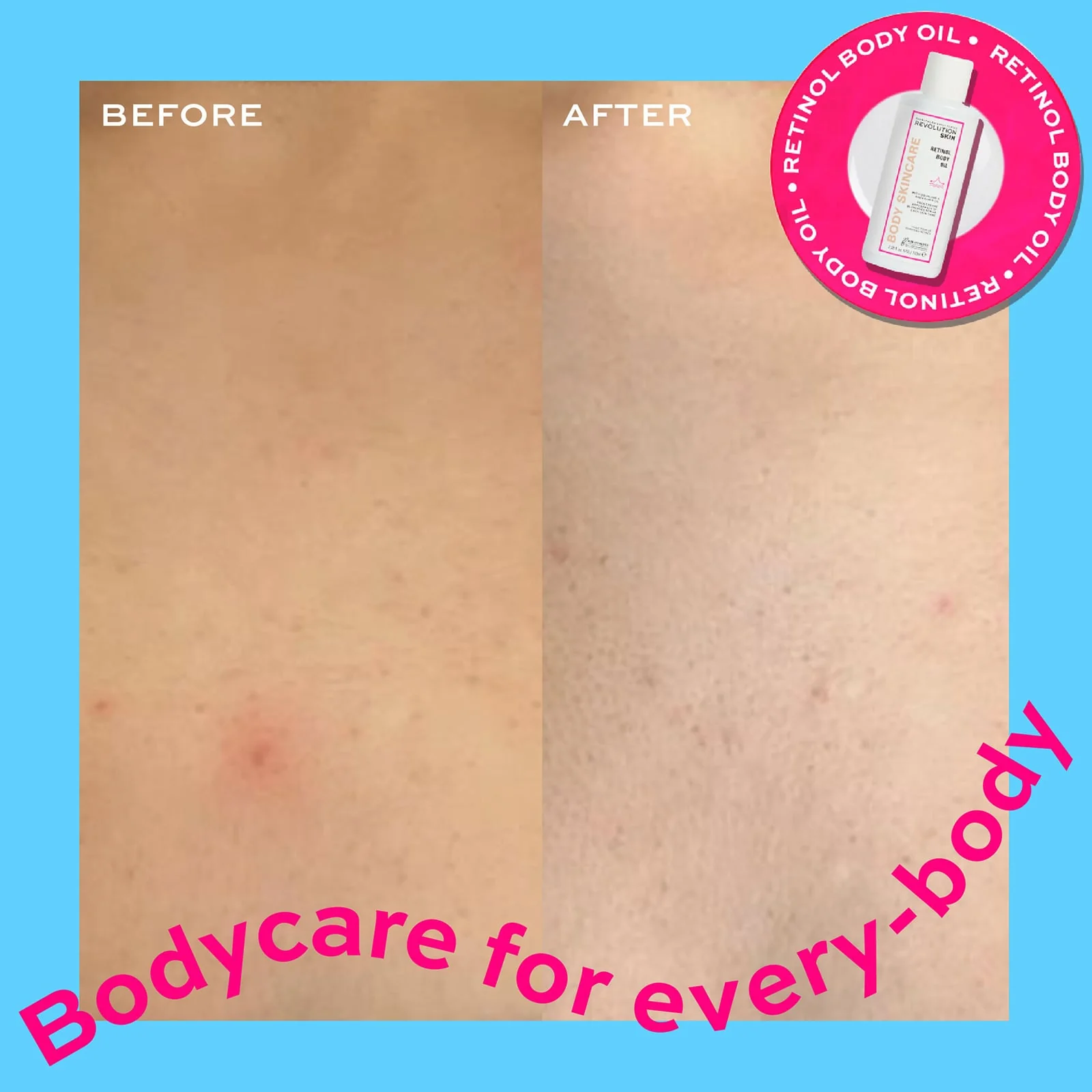 Revolution Skincare Retinol Body Oil 100ml - Image 2