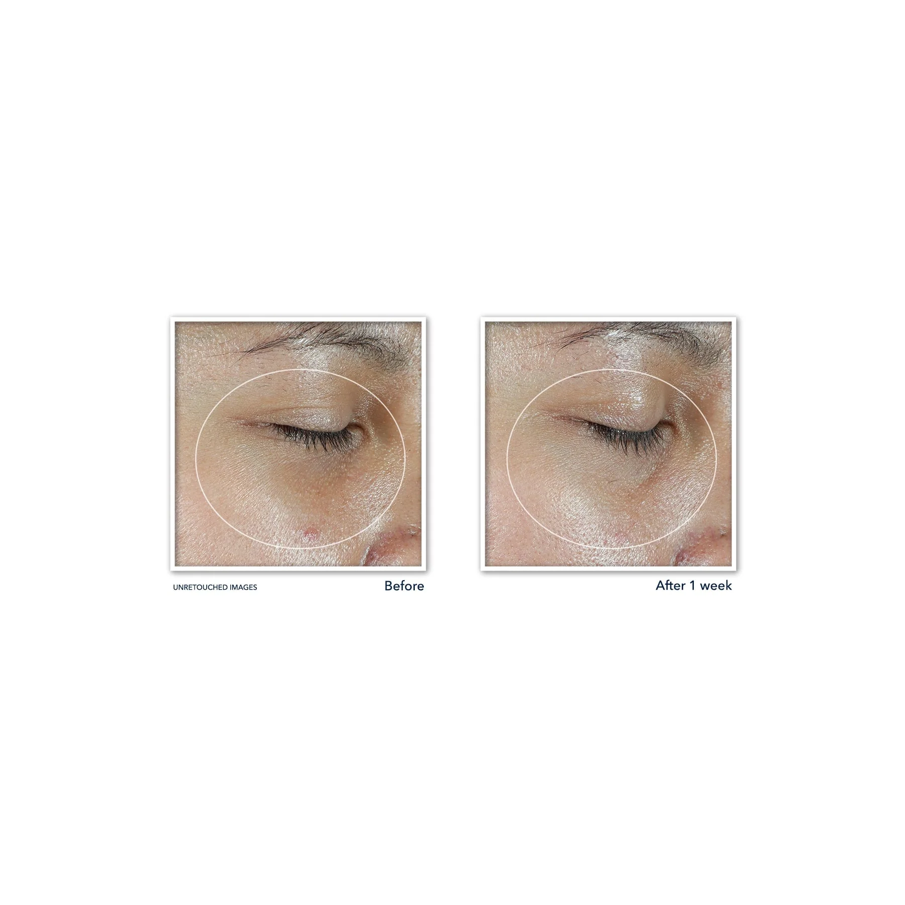 Roc Multi Correxion Revive + Glow Eye Stick - Image 4