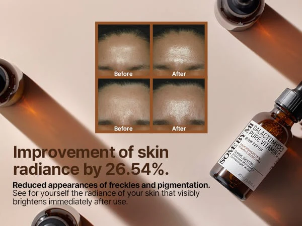 Some By Mi Galactomyces Pure Vitamin C Glow Serum 30ml - Image 4