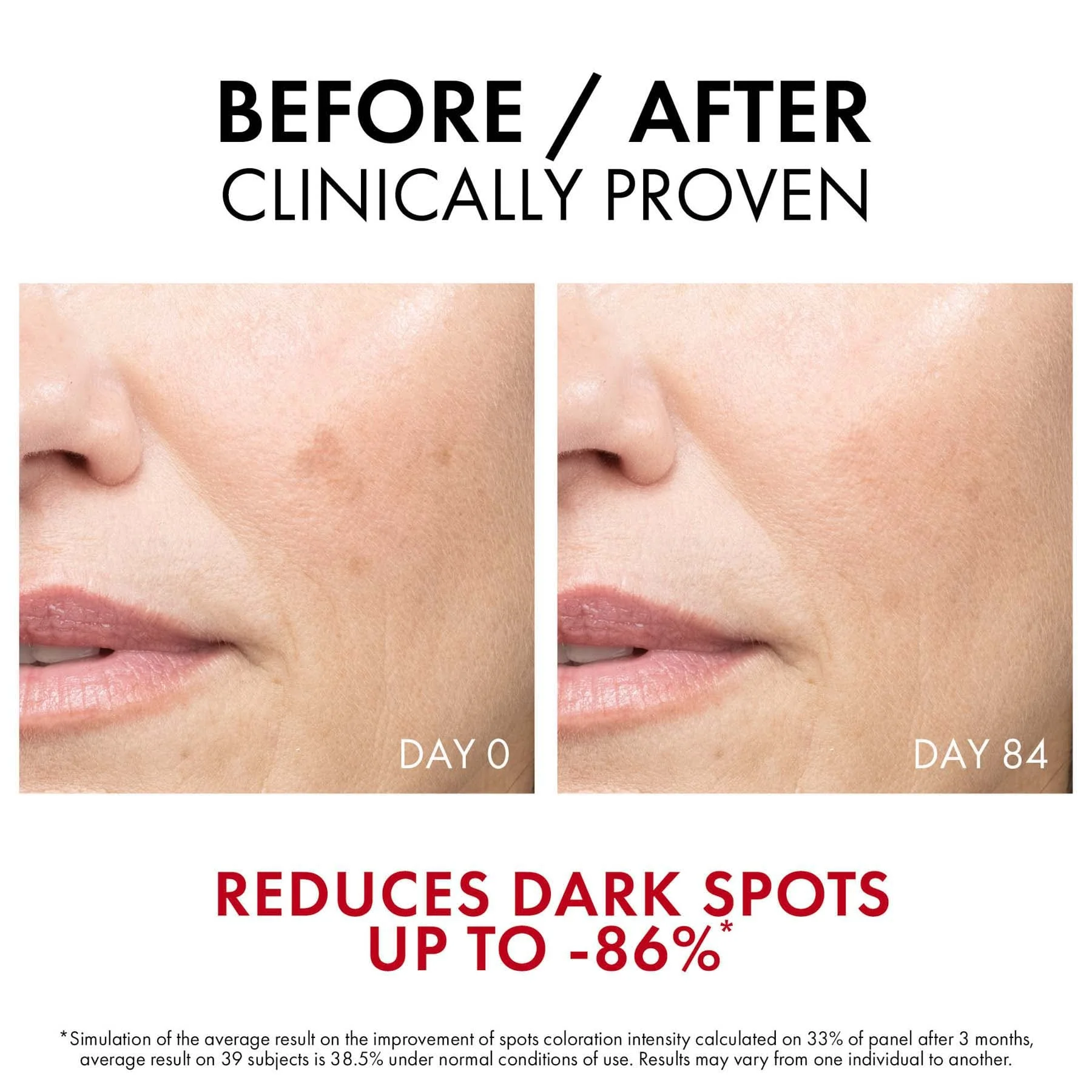 Vichy Liftactiv B3 Serum for Dark Spots - Image 5