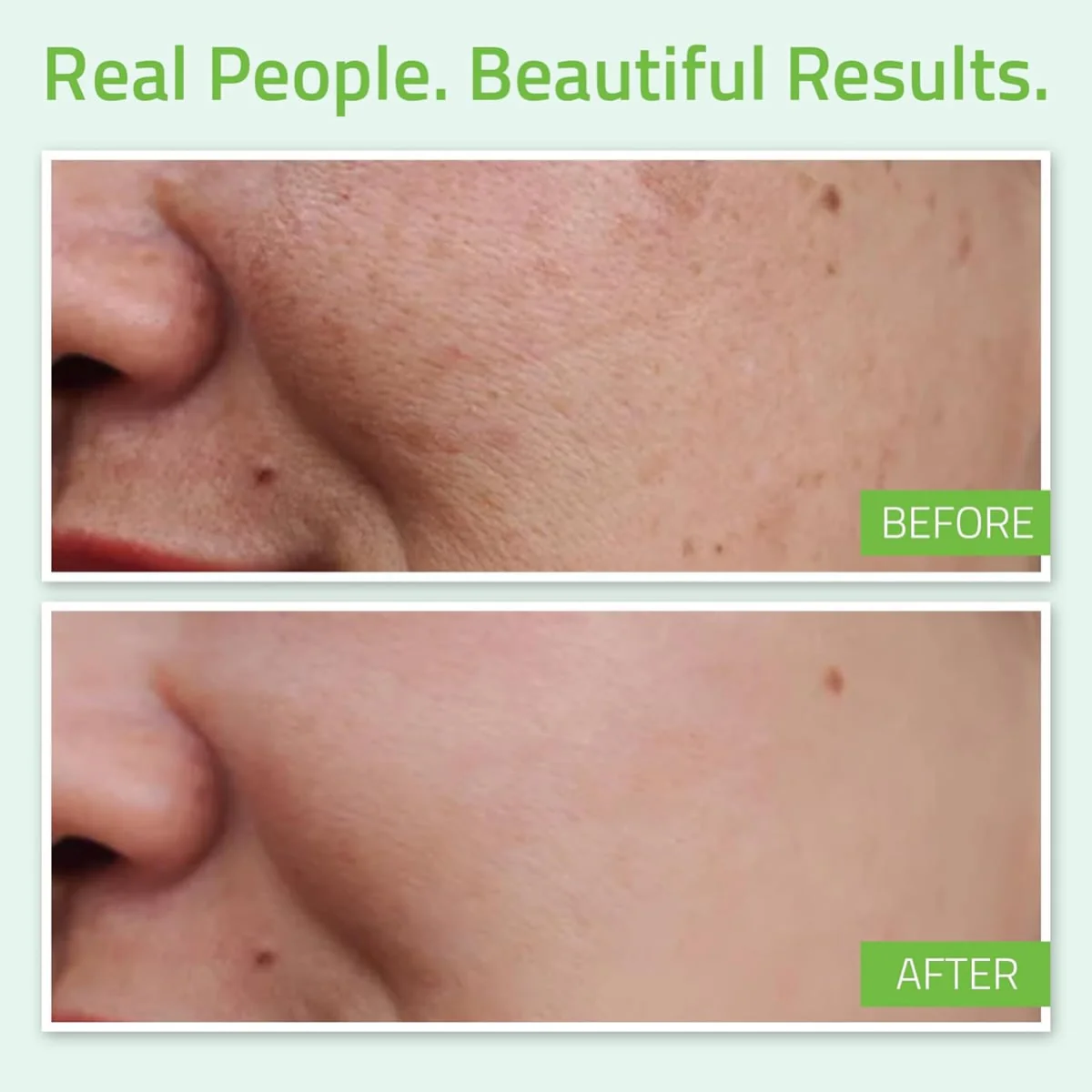 Yeouth Hyaluronic Acid Plus Serum with Vitamin C - Image 2