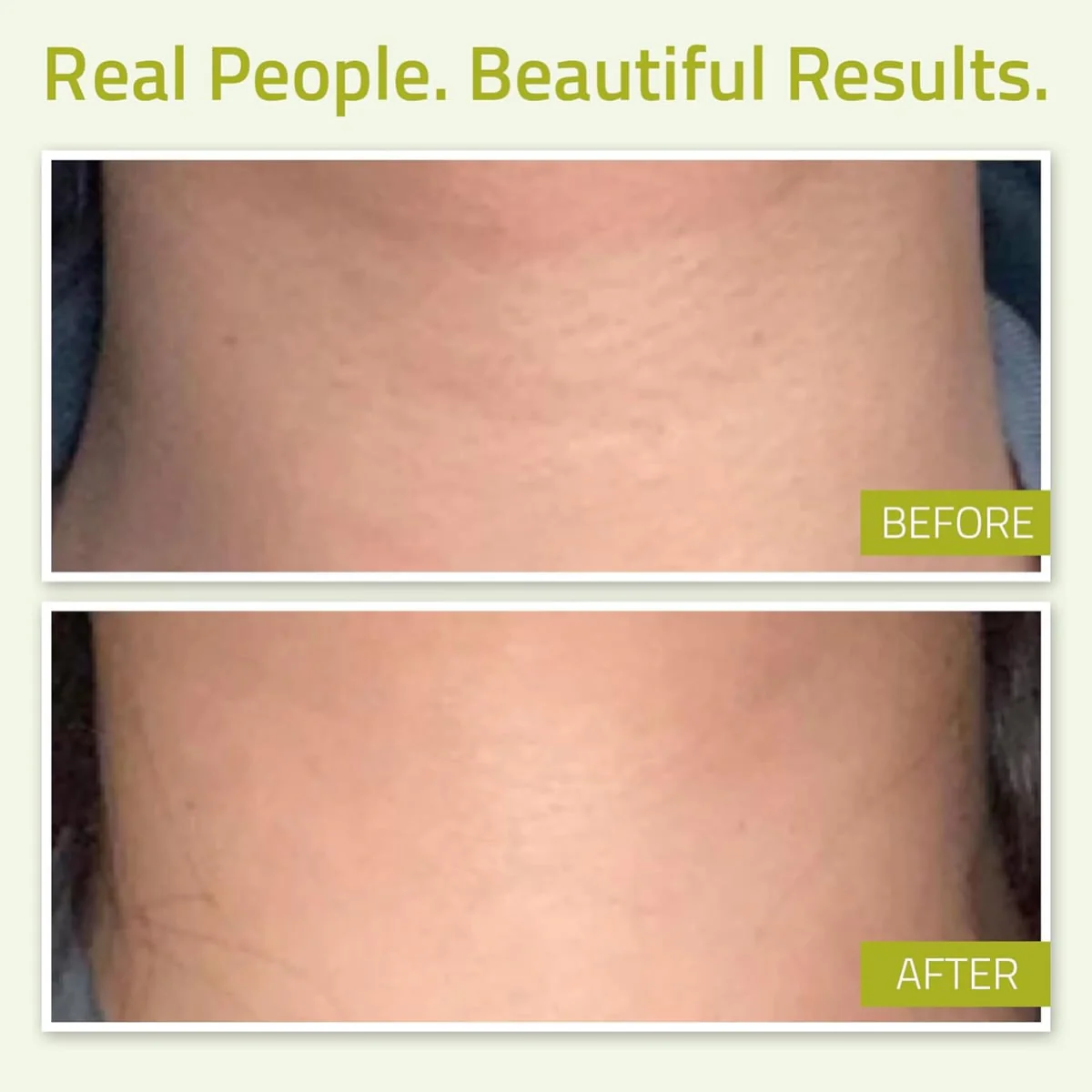 Yeouth Neck Firming Cream - Image 2