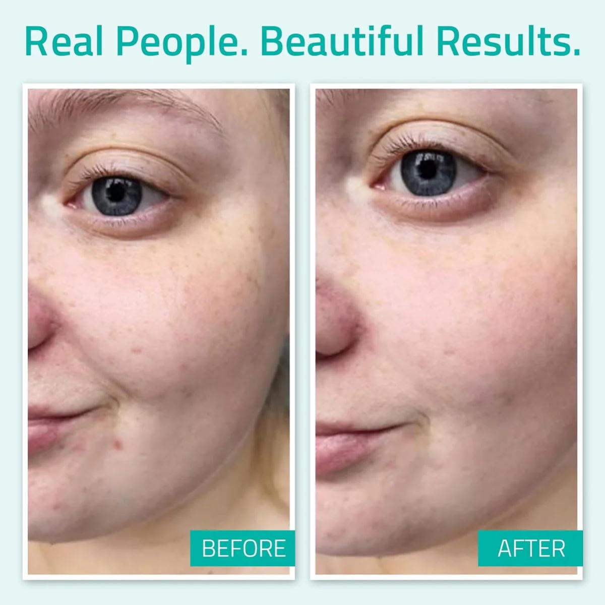 Yeouth Pure Hyaluronic Acid Serum - Image 2